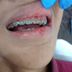 Santri Pesantren di Selayang Trauma Berat Usai Dianiaya Temannya Sendiri Foto Agus20 pesantren